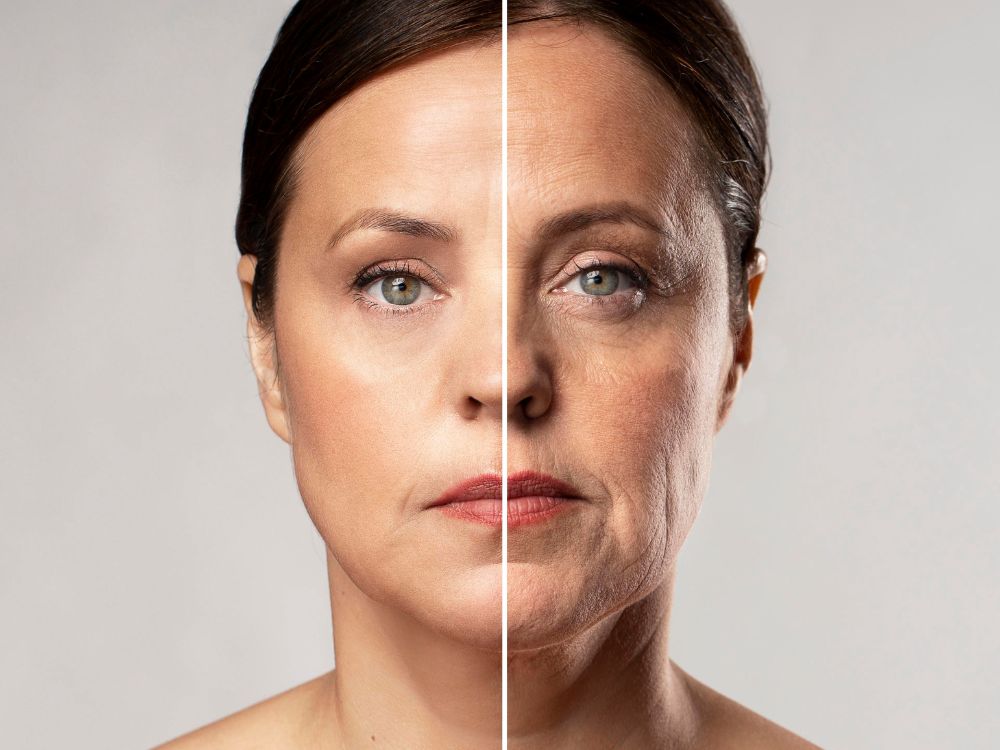 O colágeno é uma proteína presente em nosso organismo que tem como função principal dar sustentação e elasticidade à pele. Com o passar dos anos, a sua produção natural diminui, o que pode resultar em uma pele mais flácida e com rugas.